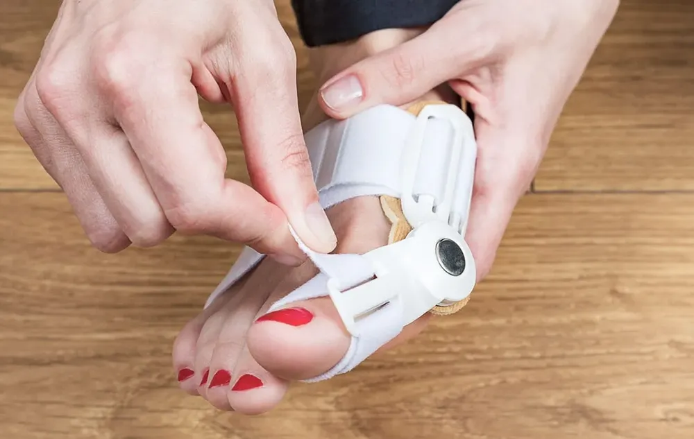 Woman wearing bunion splints for treatment