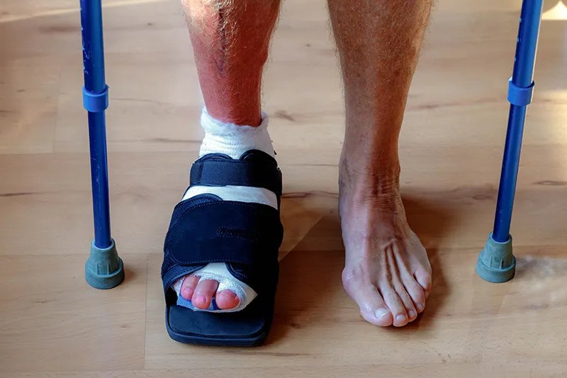 Bandaged foot after surgery.